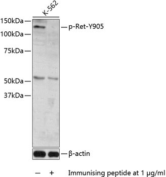 Phospho-Ret-Y905 Rabbit Polyclonal Antibody