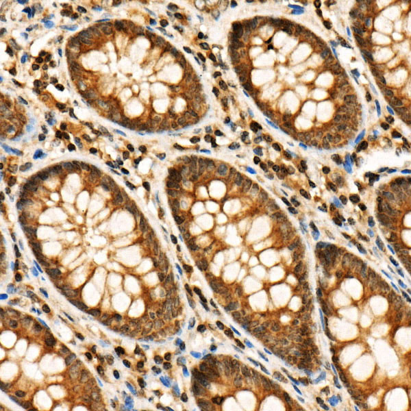 Phospho-RIP3-S227 Rabbit Polyclonal Antibody