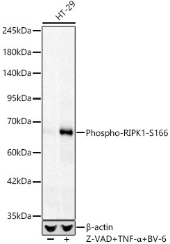 Phospho-RIPK1-S166 Rabbit Monoclonal Antibody