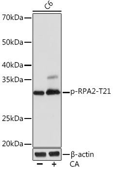 Phospho-RPA2-T21 Rabbit Monoclonal Antibody