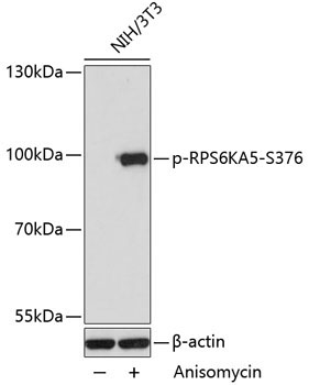 Phospho-RPS6KA5-S376 Rabbit Polyclonal Antibody