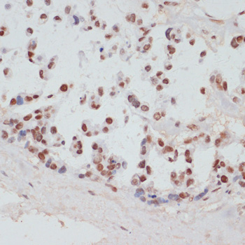 Phospho-RPS6KA5-S376 Rabbit Polyclonal Antibody - Image 3