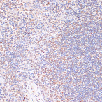 Phospho-RPS6KA5-S376 Rabbit Polyclonal Antibody - Image 4