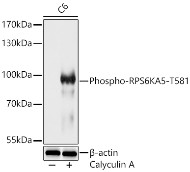 Phospho-RPS6KA5-T581 Rabbit Polyclonal Antibody