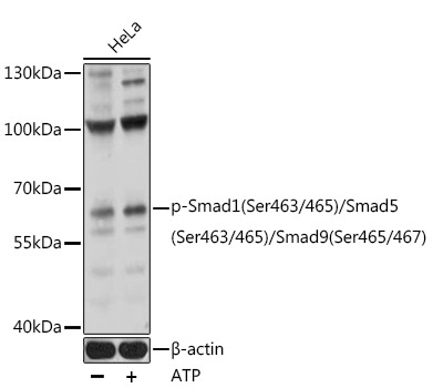 Phospho-Smad1-S463/465 + Smad5-S463/465 + Smad9-S465/467 Rabbit Polyclonal Antibody