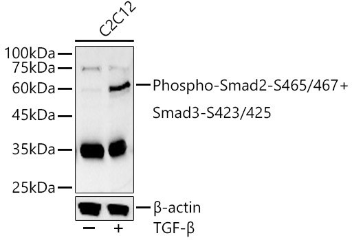 Phospho-Smad2-S465/467 + Smad3-S423/425 Rabbit Polyclonal Antibody