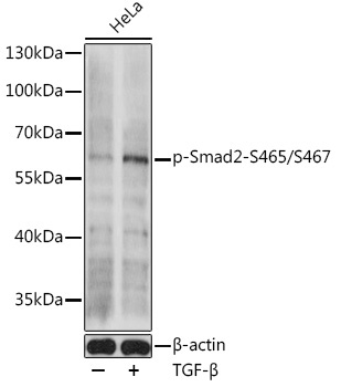 Phospho-Smad2-S465/S467 Rabbit Polyclonal Antibody