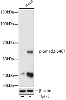 Phospho-Smad2-S467 Rabbit Polyclonal Antibody