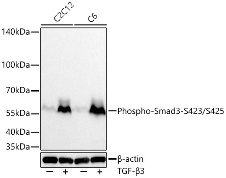Phospho-Smad3-S423/S425 Rabbit Monoclonal Antibody
