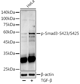 Phospho-Smad3-S423/S425 Rabbit Polyclonal Antibody
