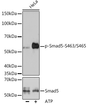 Phospho-Smad5-S463/S465 Rabbit Monoclonal Antibody