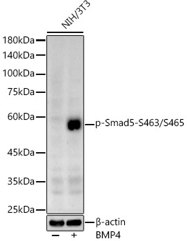 Phospho-Smad5-S463/S465 Rabbit Polyclonal Antibody