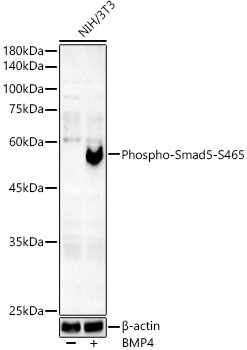 Phospho-Smad5-S465 Rabbit Monoclonal Antibody