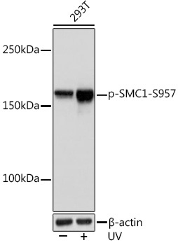 Phospho-SMC1-S957 Rabbit Monoclonal Antibody