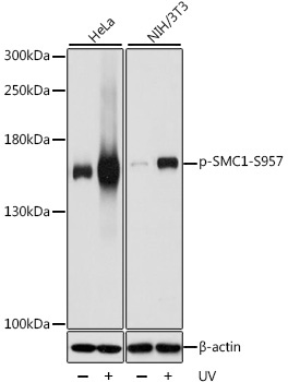 Phospho-SMC1-S957 Rabbit Polyclonal Antibody