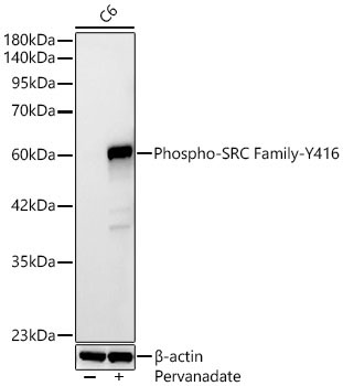 Phospho-SRC Family-Y416 Rabbit Monoclonal Antibody