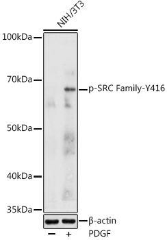 Phospho-SRC Family-Y416 Rabbit Polyclonal Antibody