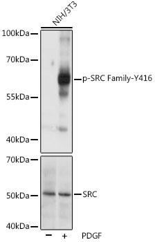 Phospho-SRC Family-Y416 Rabbit Polyclonal Antibody - Image 2