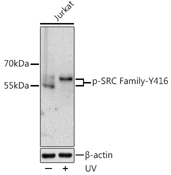 Phospho-SRC Family-Y416 Rabbit Polyclonal Antibody