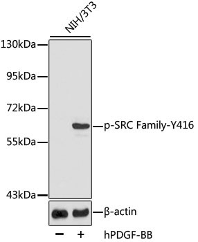 Phospho-SRC Family-Y416 Rabbit Polyclonal Antibody