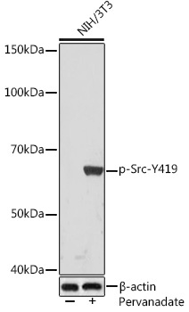 Phospho-Src-Y419 Rabbit Monoclonal Antibody