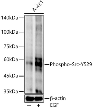 Phospho-Src-Y529 Rabbit Monoclonal Antibody