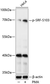 Phospho-SRF-S103 Rabbit Polyclonal Antibody