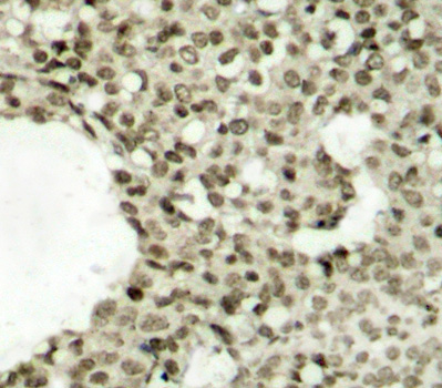 Phospho-STAT1-S727 Rabbit Polyclonal Antibody - Image 2
