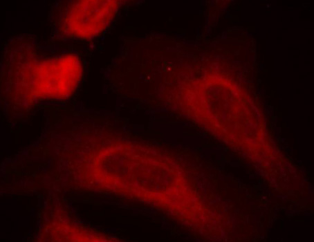 Phospho-STAT1-S727 Rabbit Polyclonal Antibody - Image 3