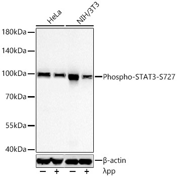 Phospho-STAT3-S727 Rabbit Monoclonal Antibody