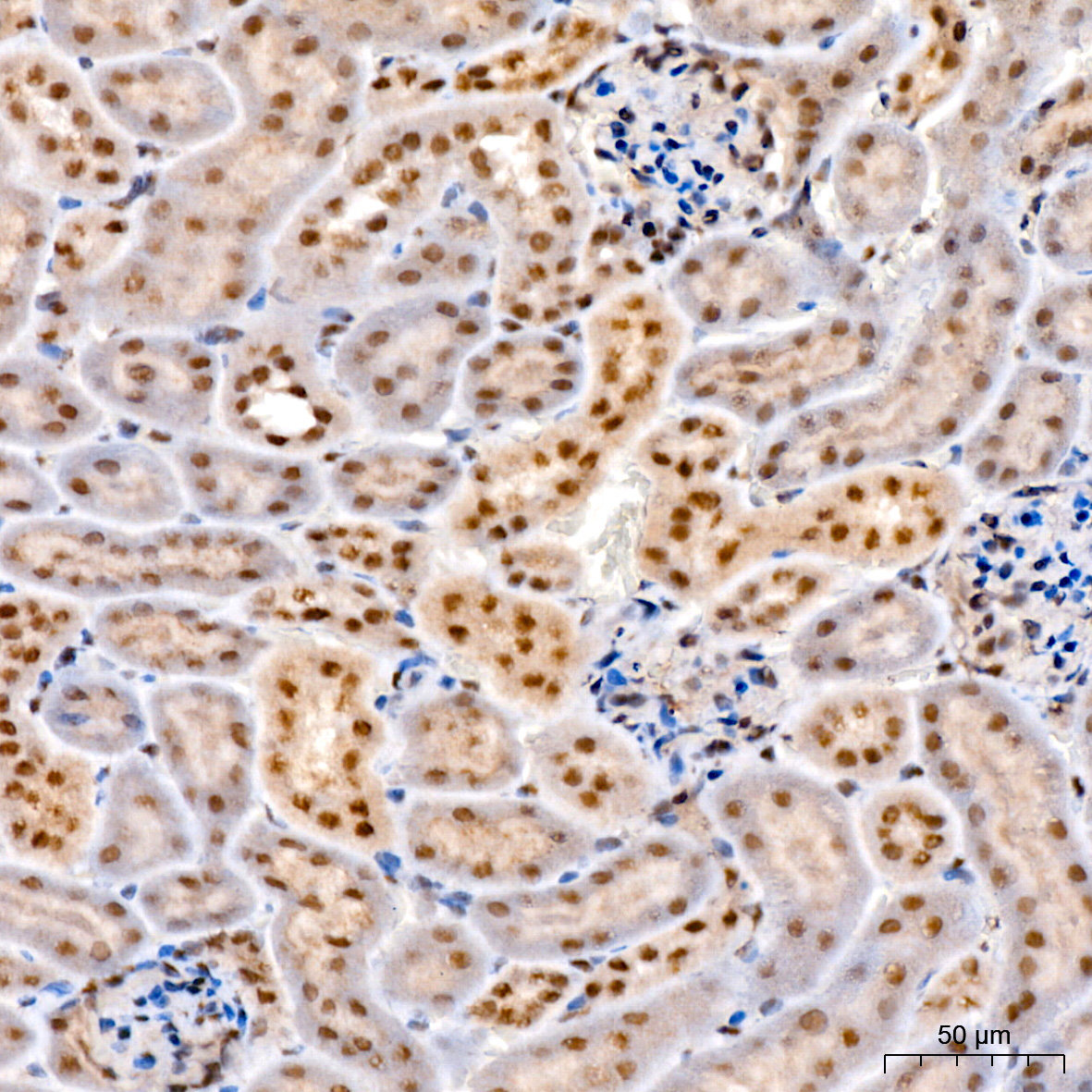 Phospho-STAT3-S727 Rabbit Monoclonal Antibody - Image 2