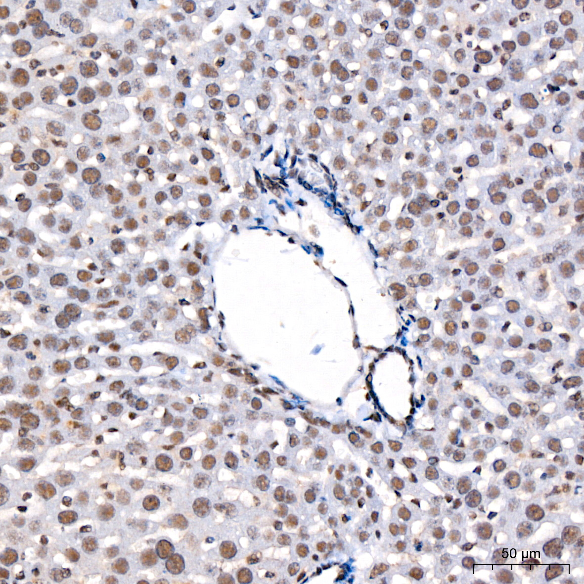 Phospho-STAT3-S727 Rabbit Monoclonal Antibody - Image 3