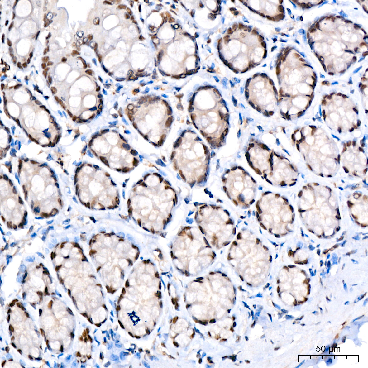 Phospho-STAT3-S727 Rabbit Monoclonal Antibody - Image 4