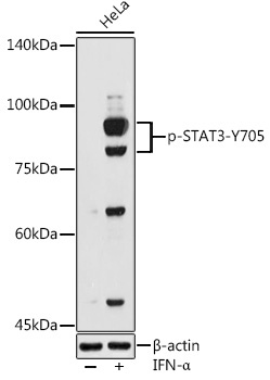 Phospho-STAT3-Y705 Rabbit Polyclonal Antibody