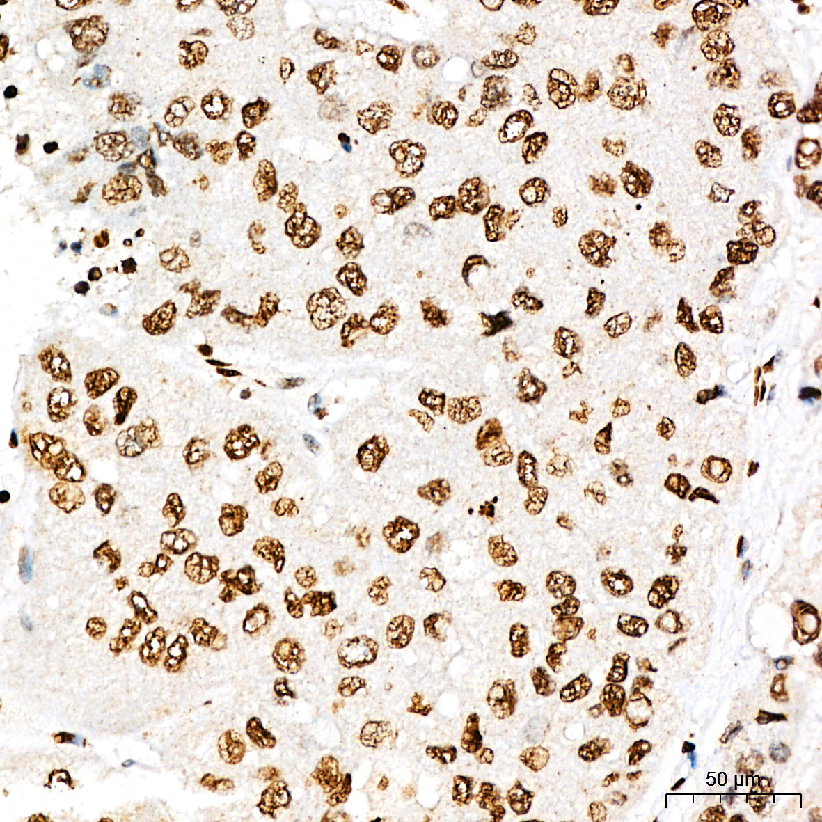 Phospho-STAT3-Y705 Rabbit Polyclonal Antibody - Image 3