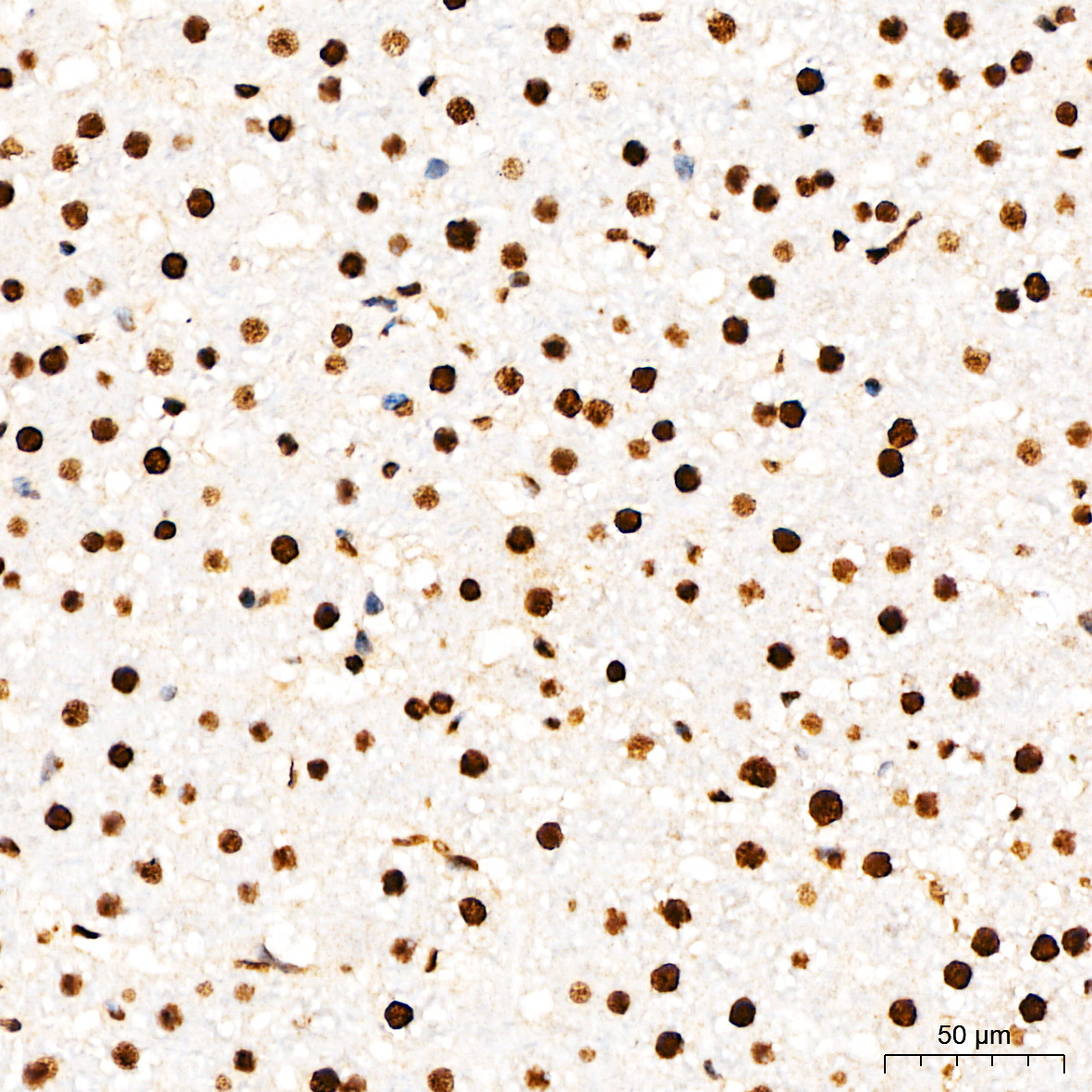 Phospho-STAT3-Y705 Rabbit Polyclonal Antibody - Image 5