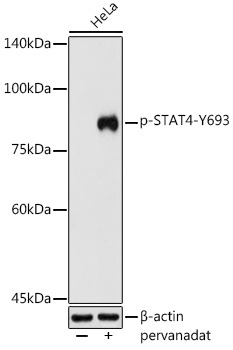 Phospho-STAT4-Y693 Rabbit Polyclonal Antibody