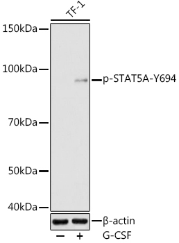 Phospho-STAT5A-Y694 Rabbit Polyclonal Antibody