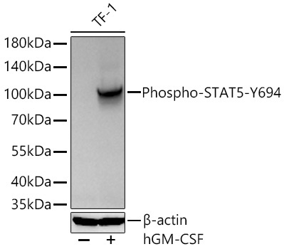 Phospho-STAT5-Y694 Rabbit Polyclonal Antibody