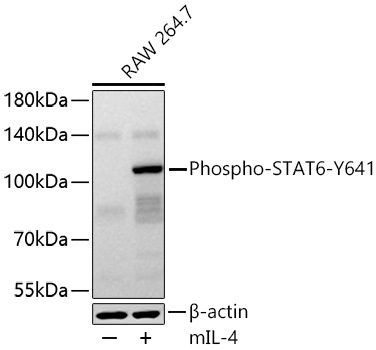 Phospho-STAT6-Y641 Rabbit Polyclonal Antibody