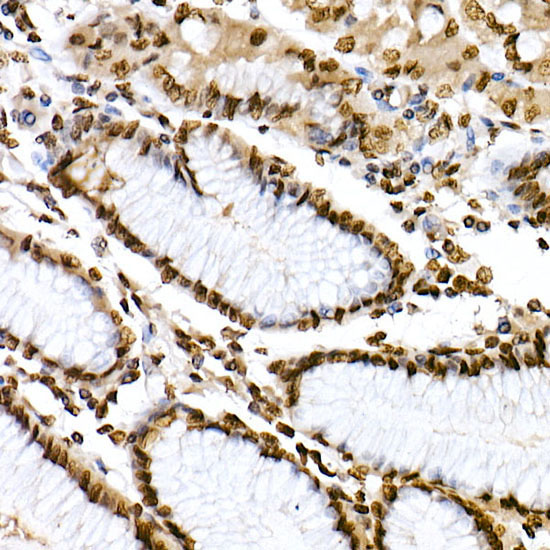 Phospho-STAT6-Y641 Rabbit Polyclonal Antibody - Image 2