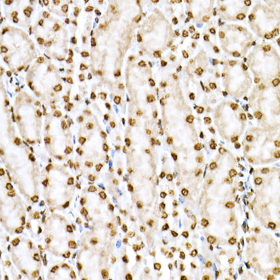 Phospho-STAT6-Y641 Rabbit Polyclonal Antibody - Image 3