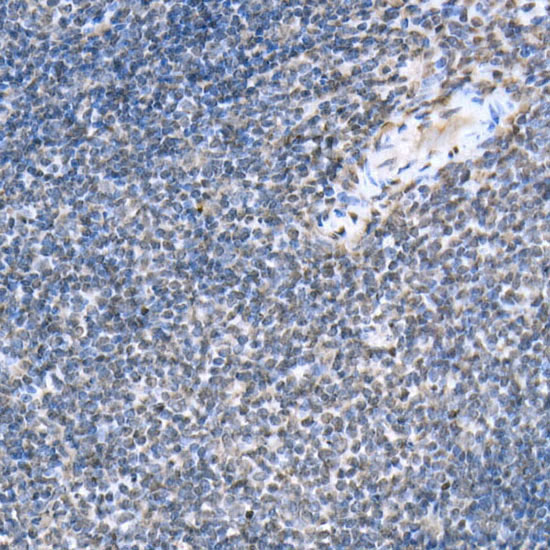 Phospho-STAT6-Y641 Rabbit Polyclonal Antibody - Image 4