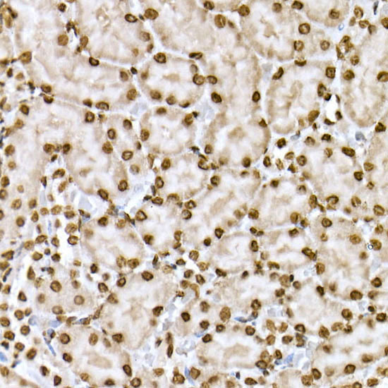 Phospho-STAT6-Y641 Rabbit Polyclonal Antibody - Image 5