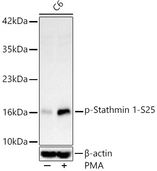 Phospho-Stathmin 1-S25 Rabbit Monoclonal Antibody