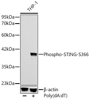 Phospho-STING/TMEM173-S366 Rabbit Monoclonal Antibody