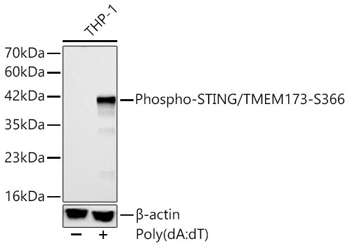 Phospho-STING/TMEM173-S366 Rabbit Polyclonal Antibody