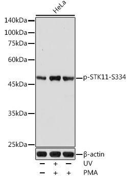 Phospho-STK11-S334 Rabbit Polyclonal Antibody
