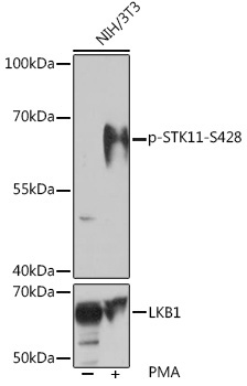 Phospho-STK11-S428 Rabbit Polyclonal Antibody