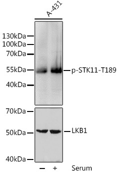 Phospho-STK11-T189 Rabbit Polyclonal Antibody